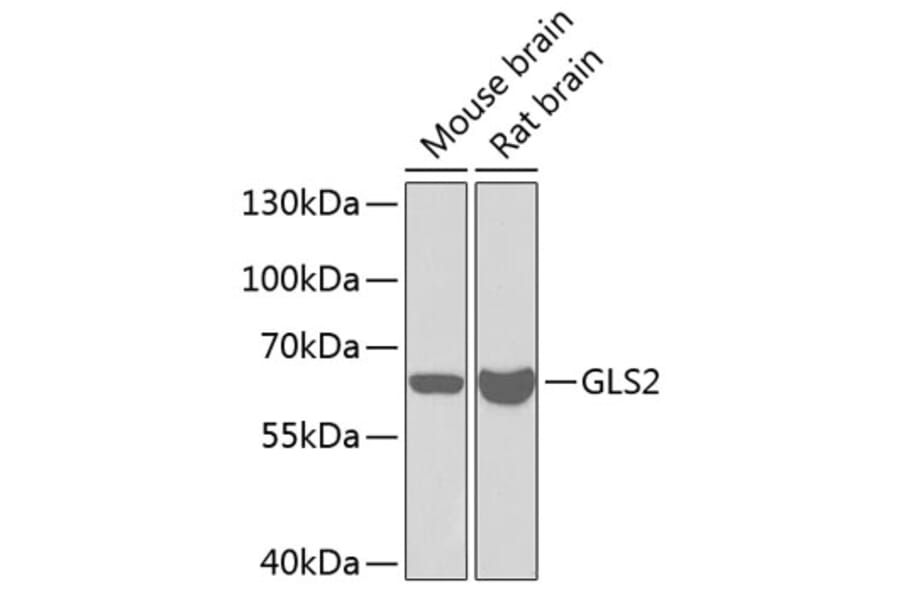 Western Blot - Anti-GLS2 Antibody (A11946) - Antibodies.com