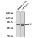 Western Blot - Anti-GLS2 Antibody (A11946) - Antibodies.com