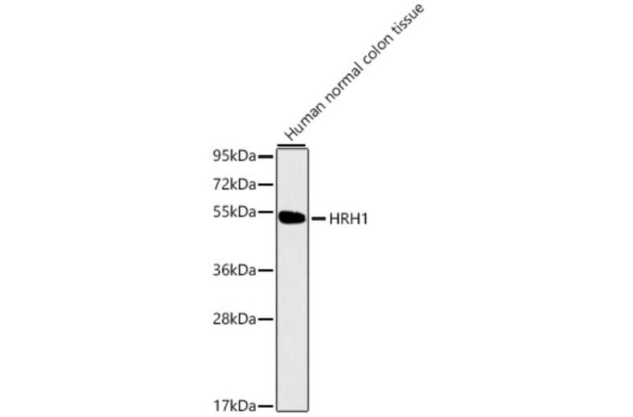 Western Blot - Anti-HRH1/H1R Antibody (A80554) - Antibodies.com