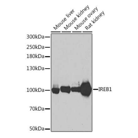 Western Blot - Anti-Aconitase 1 Antibody (A80555) - Antibodies.com