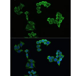 Immunofluorescence - Anti-Amyloid Precursor Protein Antibody (A80556) - Antibodies.com