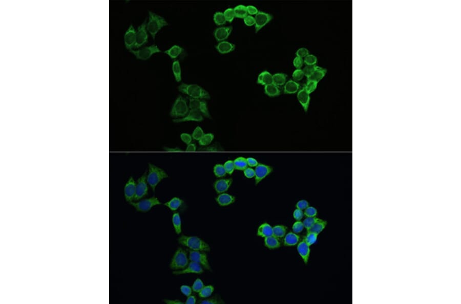 Anti Amyloid Precursor Protein Antibody A80556