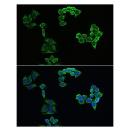 Immunofluorescence - Anti-Amyloid Precursor Protein Antibody (A80556) - Antibodies.com