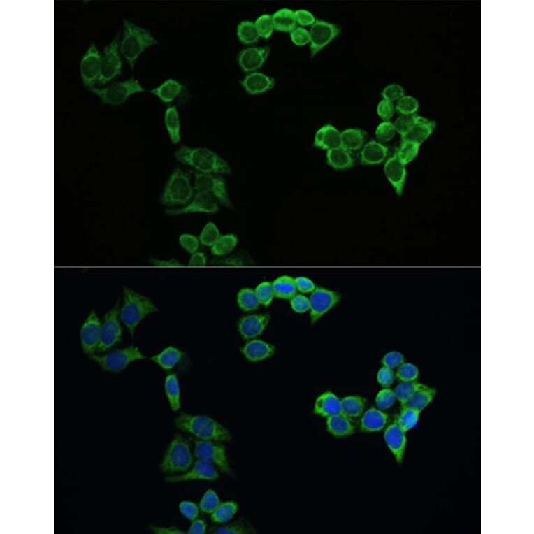 Immunofluorescence - Anti-Amyloid Precursor Protein Antibody (A80556) - Antibodies.com