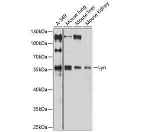 Western Blot - Anti-Lyn Antibody (A80557) - Antibodies.com