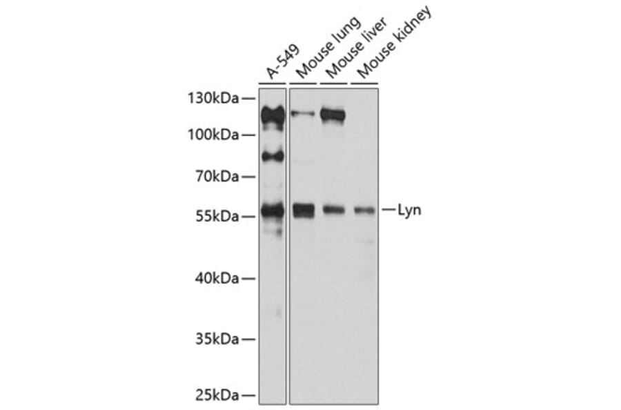 Western Blot - Anti-Lyn Antibody (A80557) - Antibodies.com