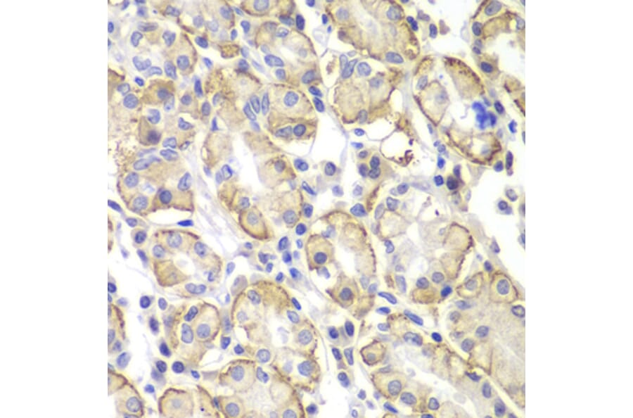 Immunohistochemistry - Anti-Lyn Antibody (A80557) - Antibodies.com