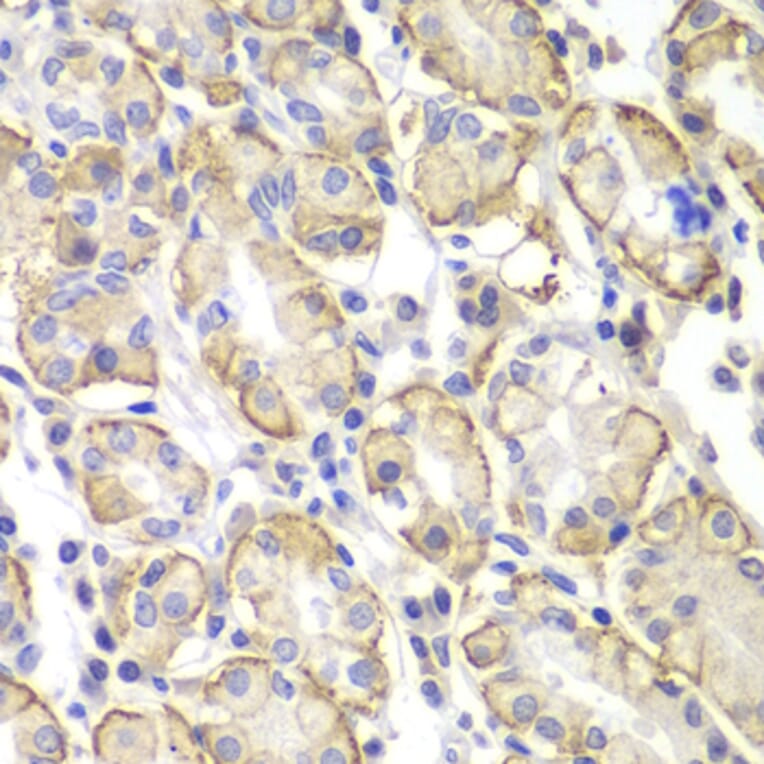 Immunohistochemistry - Anti-Lyn Antibody (A80557) - Antibodies.com