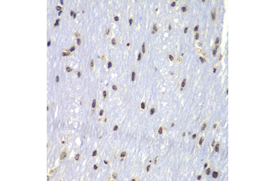 Immunohistochemistry - Anti-Lyn Antibody (A80557) - Antibodies.com