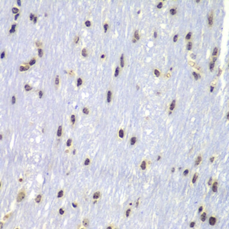 Immunohistochemistry - Anti-Lyn Antibody (A80557) - Antibodies.com