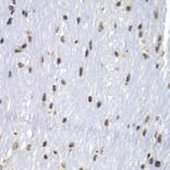 Immunohistochemistry - Anti-Lyn Antibody (A80557) - Antibodies.com