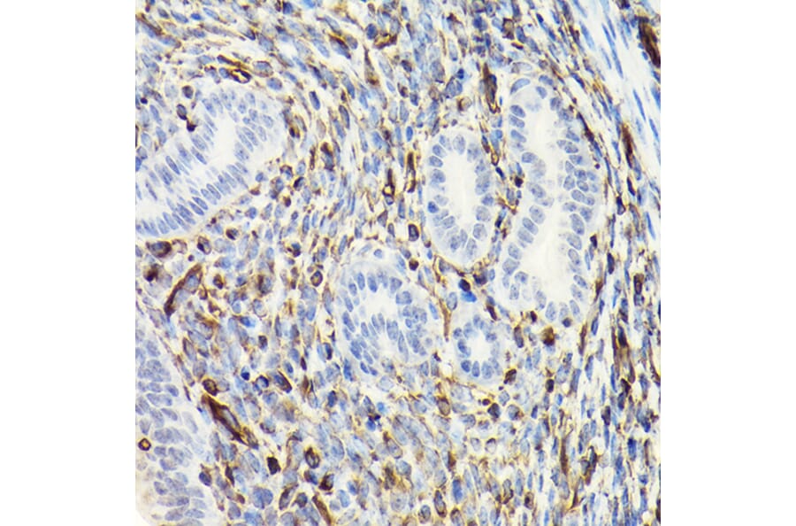 Immunohistochemistry - Anti-Vimentin Antibody (A80558) - Antibodies.com