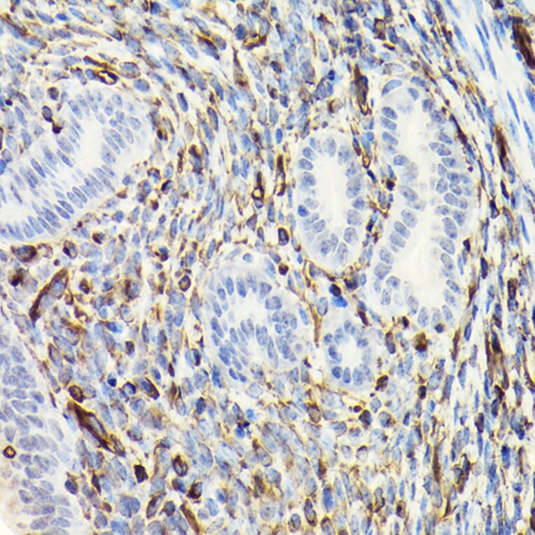 Immunohistochemistry - Anti-Vimentin Antibody (A80558) - Antibodies.com