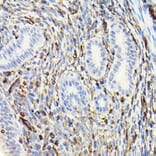 Immunohistochemistry - Anti-Vimentin Antibody (A80558) - Antibodies.com