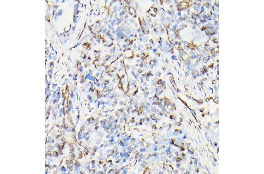 Immunohistochemistry - Anti-Vimentin Antibody (A80558) - Antibodies.com