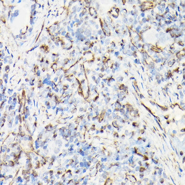Immunohistochemistry - Anti-Vimentin Antibody (A80558) - Antibodies.com