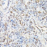 Immunohistochemistry - Anti-Vimentin Antibody (A80558) - Antibodies.com