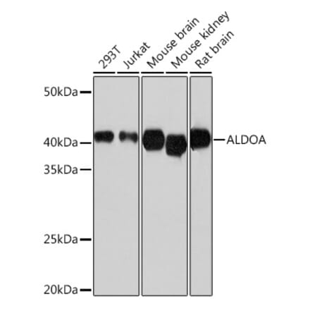 Western Blot - Anti-Aldolase Antibody [ARC0598] (A80559) - Antibodies.com