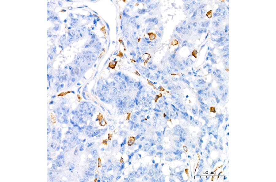 Immunohistochemistry - Anti-TNF alpha Antibody (A80560) - Antibodies.com