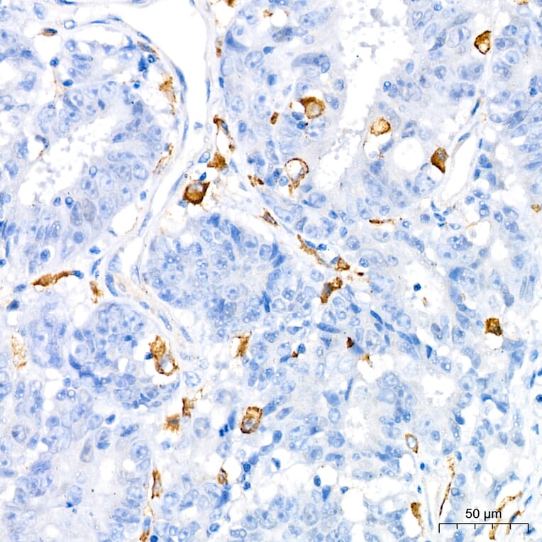 Immunohistochemistry - Anti-TNF alpha Antibody (A80560) - Antibodies.com