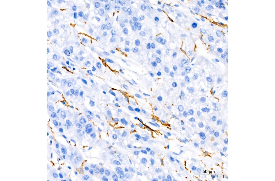 Immunohistochemistry - Anti-TNF alpha Antibody (A80560) - Antibodies.com