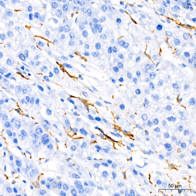 Immunohistochemistry - Anti-TNF alpha Antibody (A80560) - Antibodies.com