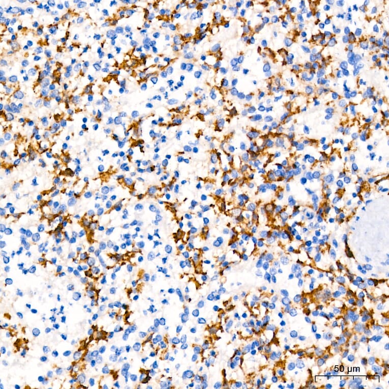 Immunohistochemistry - Anti-TNF alpha Antibody (A80560) - Antibodies.com