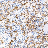 Immunohistochemistry - Anti-TNF alpha Antibody (A80560) - Antibodies.com