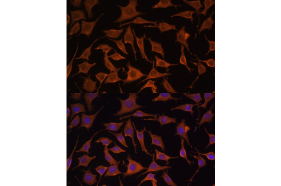 Immunofluorescence - Anti-TNF alpha Antibody (A80560) - Antibodies.com