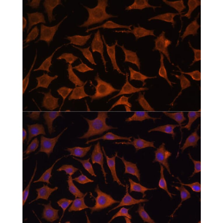 Immunofluorescence - Anti-TNF alpha Antibody (A80560) - Antibodies.com