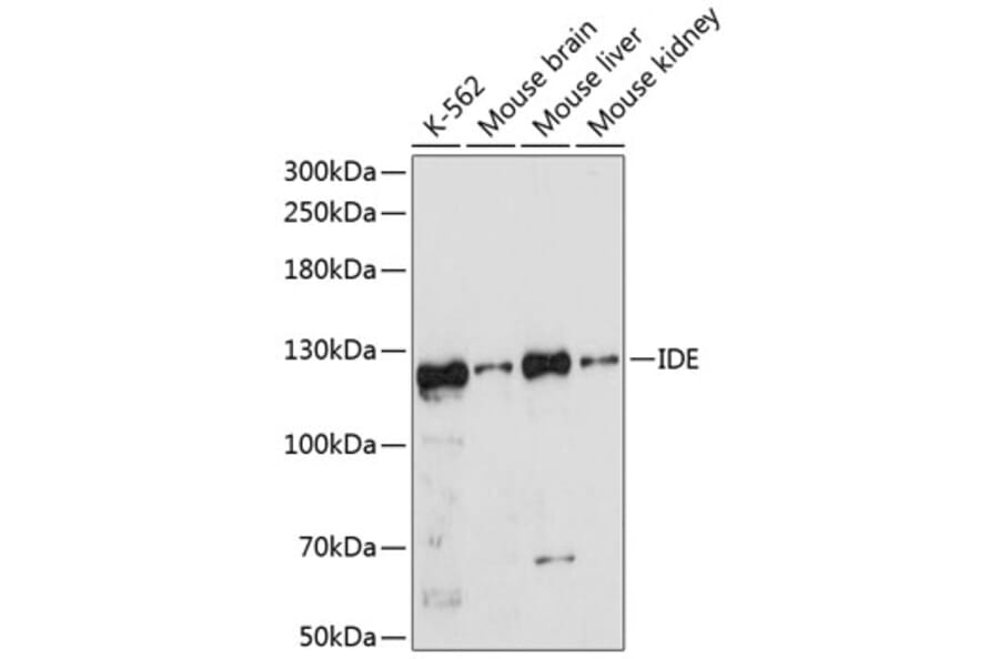 Western Blot - Anti-IDE Antibody (A11809) - Antibodies.com