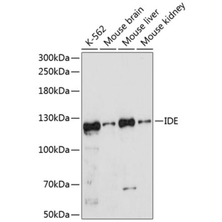 Western Blot - Anti-IDE Antibody (A11809) - Antibodies.com