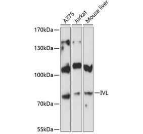 Western Blot - Anti-Involucrin Antibody (A80562) - Antibodies.com