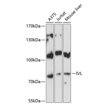 Western Blot - Anti-Involucrin Antibody (A80562) - Antibodies.com