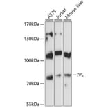 Western Blot - Anti-Involucrin Antibody (A80562) - Antibodies.com