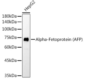 Western Blot - Anti-alpha 1 Fetoprotein Antibody [AMC0029] (A80565) - Antibodies.com
