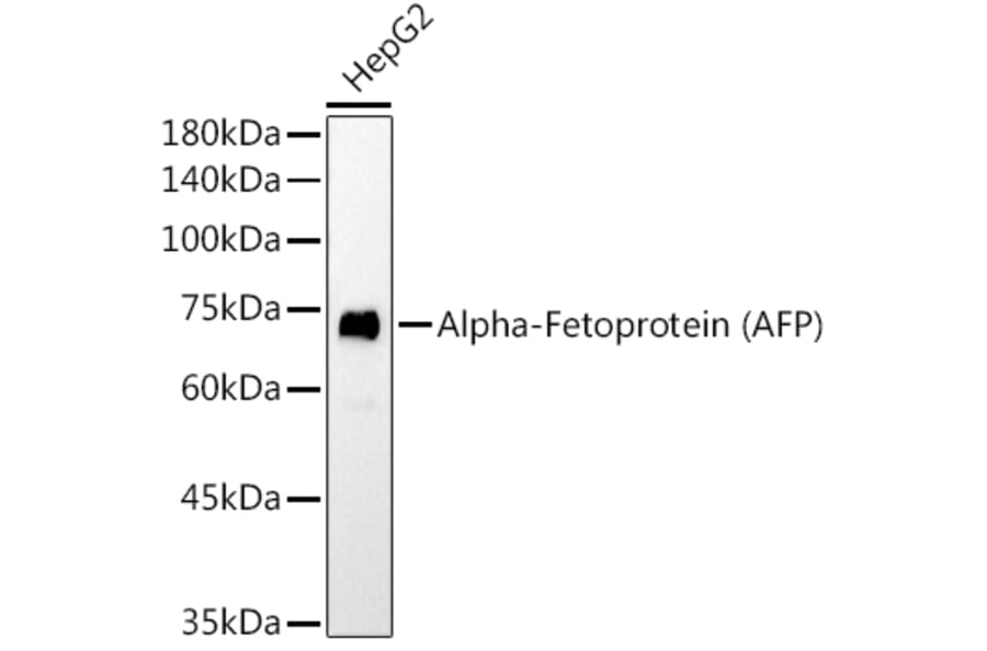 Western Blot - Anti-alpha 1 Fetoprotein Antibody [AMC0029] (A80565) - Antibodies.com