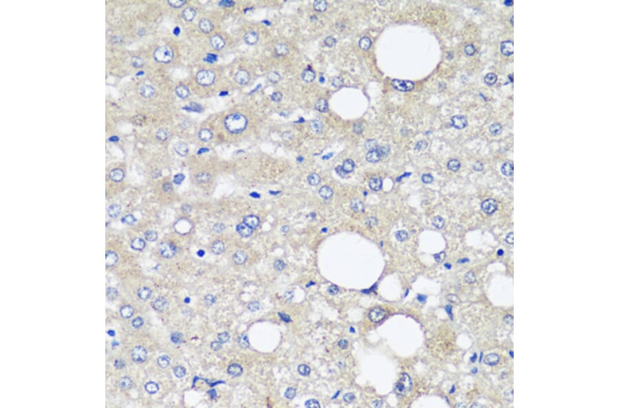 Immunohistochemistry - Anti-alpha 1 Fetoprotein Antibody [AMC0029] (A80565) - Antibodies.com