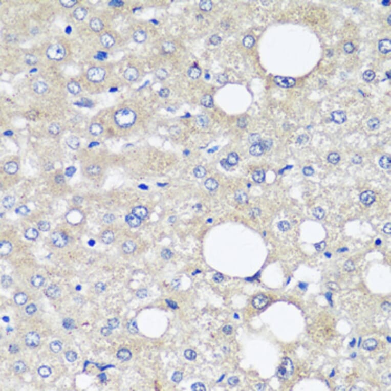 Immunohistochemistry - Anti-alpha 1 Fetoprotein Antibody [AMC0029] (A80565) - Antibodies.com