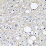 Immunohistochemistry - Anti-alpha 1 Fetoprotein Antibody [AMC0029] (A80565) - Antibodies.com