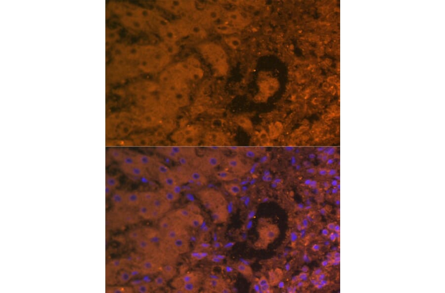 Immunofluorescence - Anti-alpha 1 Fetoprotein Antibody [AMC0029] (A80565) - Antibodies.com