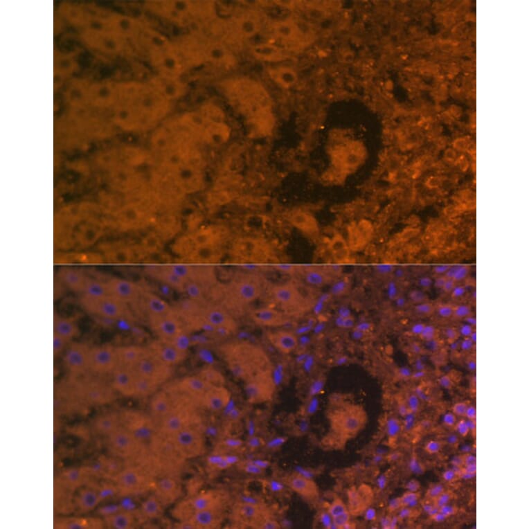 Immunofluorescence - Anti-alpha 1 Fetoprotein Antibody [AMC0029] (A80565) - Antibodies.com