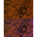 Immunofluorescence - Anti-alpha 1 Fetoprotein Antibody [AMC0029] (A80565) - Antibodies.com