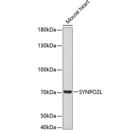Western Blot - Anti-SYNPO2L Antibody (A80566) - Antibodies.com