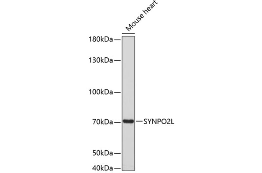 Western Blot - Anti-SYNPO2L Antibody (A80566) - Antibodies.com