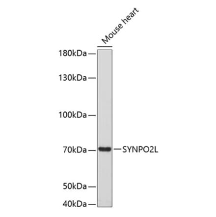 Western Blot - Anti-SYNPO2L Antibody (A80566) - Antibodies.com