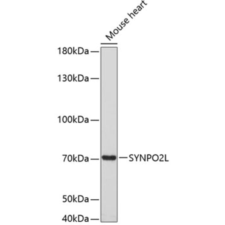 Western Blot - Anti-SYNPO2L Antibody (A80566) - Antibodies.com