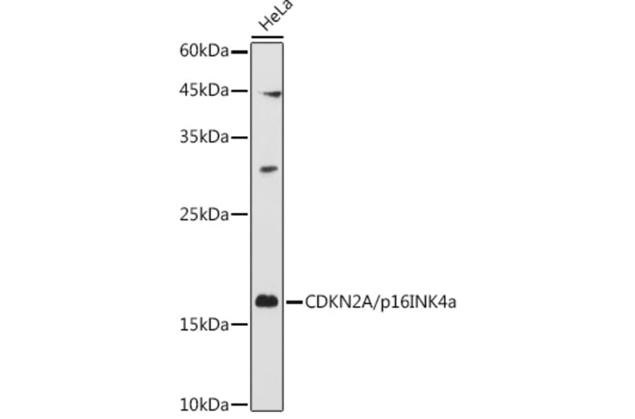 Western Blot - Anti-CDKN2A/p16INK4aF Antibody (A80567) - Antibodies.com