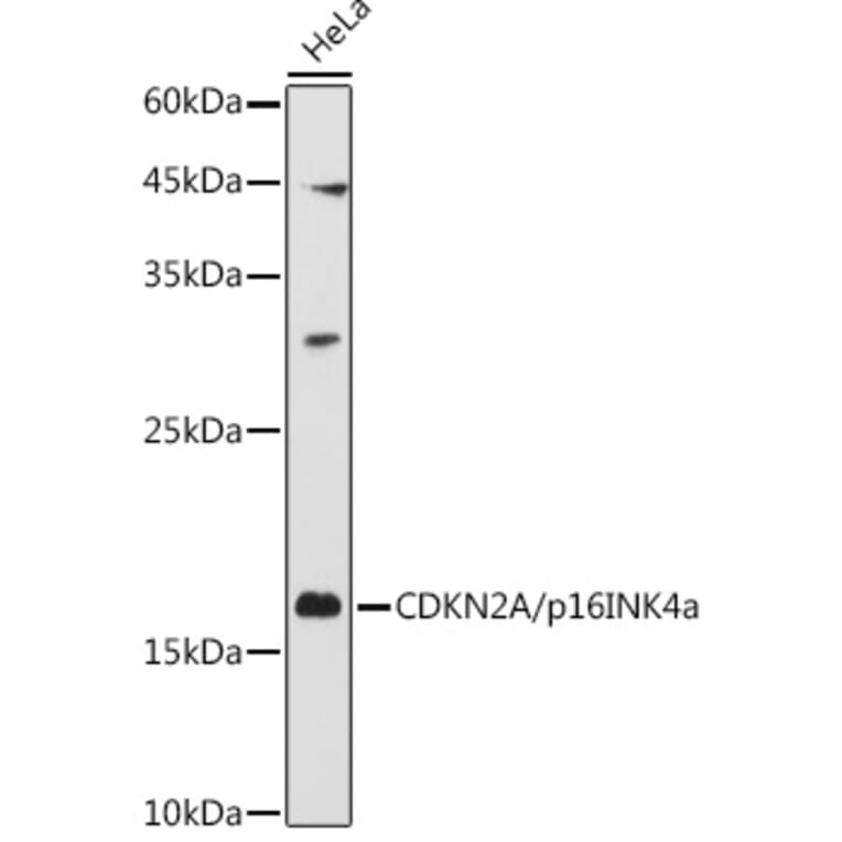 Western Blot - Anti-CDKN2A/p16INK4aF Antibody (A80567) - Antibodies.com