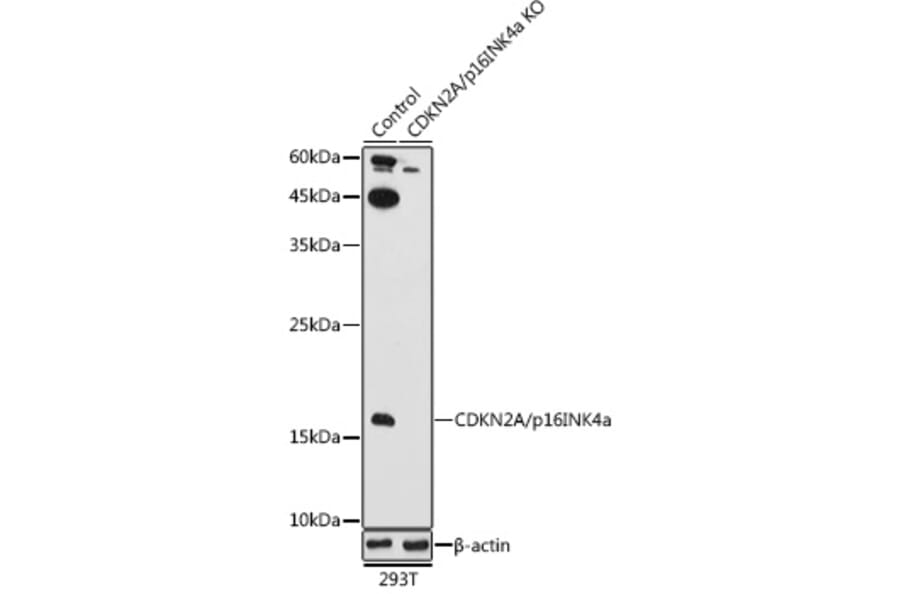 Western Blot - Anti-CDKN2A/p16INK4aF Antibody (A80567) - Antibodies.com
